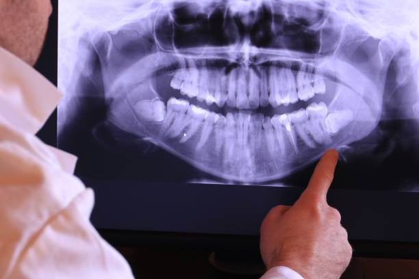 Best Emergency Dental Surgery in Winder, GA