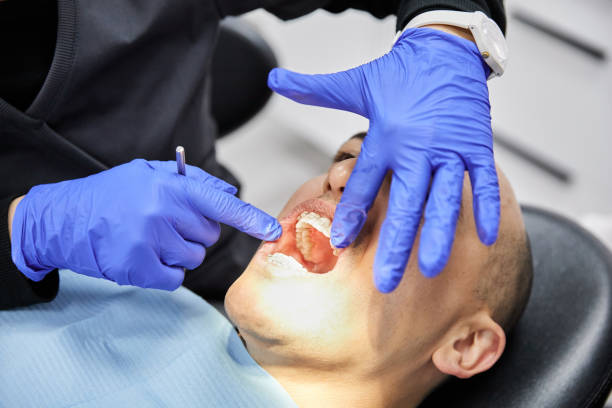 Best Emergency Wisdom Teeth Removal in Winder, GA
