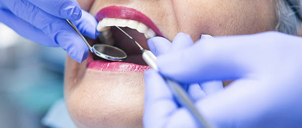 Best Emergency Treatment for Toothache in Winder, GA